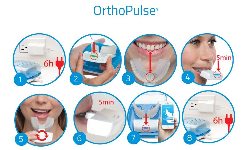 El Dr. Lacasa acreditado como usuario Platinum de la aceleración Orthopulse® valdemoro