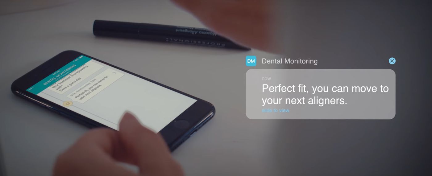 Presentamos Dental Monitoring: La primera App móvil para seguir tu tratamiento de ortodoncia