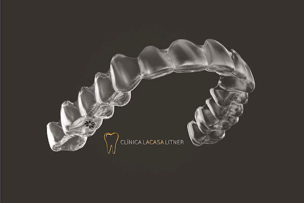 Las 5 fases del tratamiento con ortodoncia Invisalign®