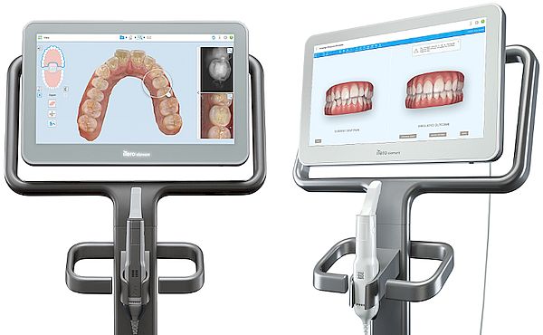 la única clínica dental de Valdemoro con dos escáneres iTero