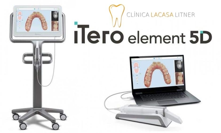 Somos la única clínica dental de Valdemoro con dos escáneres iTero
