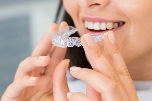 Ortodoncia con alineadores ¿Invisalign o Spark?