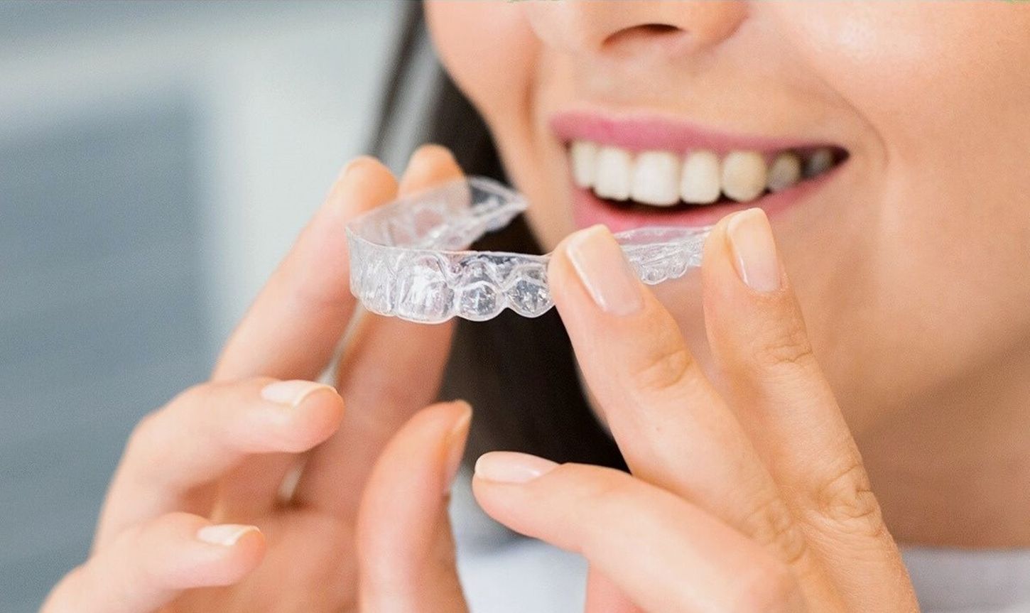 Ortodoncia con alineadores ¿Invisalign o Spark?