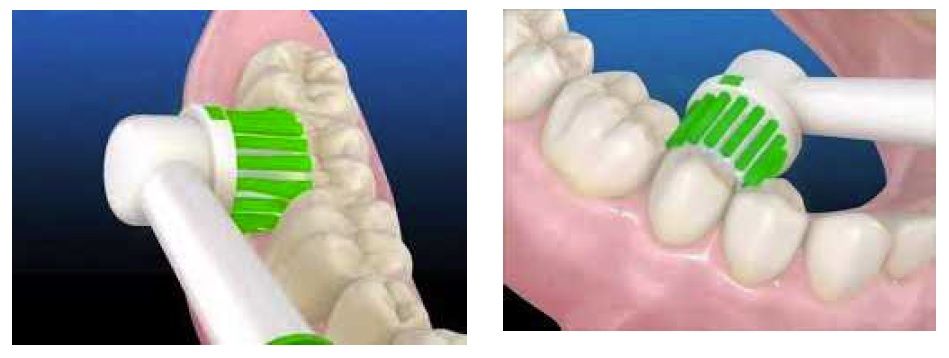 Sabéis cuándo llevar a vuestro hijo al dentista clinica dental lacasa litner valdemoro