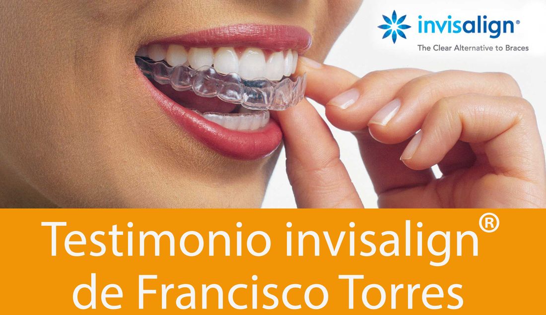 Testimonio de Paco sobre su tratamiento invisalign®