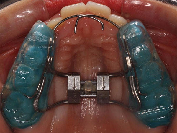 Ortopedia dentofacial